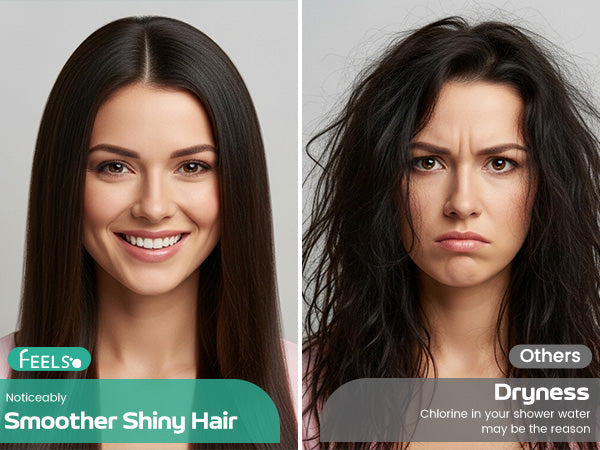 Starting with Scalp Health: How Water Quality Affects Dandruff and Oil Production